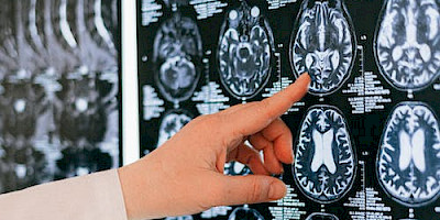 Neurologie