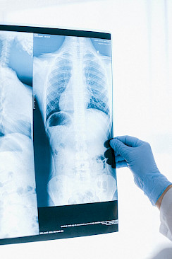 Thoraxchirurgie