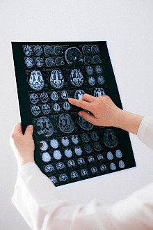 Neurochirurgie