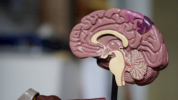 Neurologie