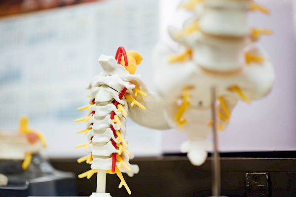 Spondylodese