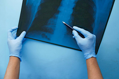 Thoraxchirurgie